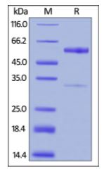 Human TNFSF11, Fc tag on SDS-PAGE under reducing (R) condition. The gel was stained overnight with Coomassie Blue. The purity of the protein is greater than 90%.